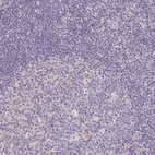 Anti-PPFIA4 Antibody