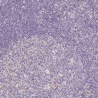 Immunohistochemical staining of human tonsil shows low expression as expected.