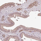 Anti-OLFML2B Antibody