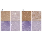 Immunohistochemical staining of human cerebral cortex, heart muscle, lymphoid tissues and pancreas using Anti-CAP2 antibody HPA054147 (A) shows similar protein distribution across tissues to independent antibody HPA050530 (B).