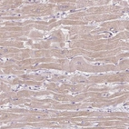 Immunohistochemical staining of human heart muscle shows moderate cytoplasmic positivity in cardiomyocytes.