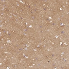 Immunohistochemical staining of human cerebral cortex shows strong cytoplasmic positivity in neuropil.