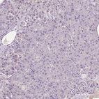 Immunohistochemical staining of human pancreas shows no positivity in exocrine glandular cells as expected.