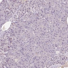 Immunohistochemical staining of human pancreas shows no positivity in exocrine glandular cells as expected.