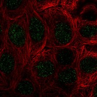 Anti-COMMD10 Antibody
