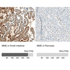 Anti-MME Antibody