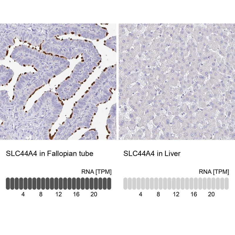 Anti-SLC44A4 Antibody