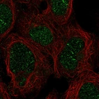 Anti-ZNF212 Antibody