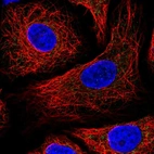 Immunofluorescent staining of human cell line A549 shows localization to mitochondria.
