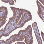 Immunohistochemical staining of human fallopian tube shows moderate cytoplasmic positivity in glandular cells.