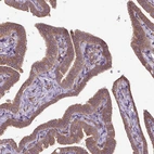 Immunohistochemical staining of human fallopian tube shows moderate cytoplasmic positivity in glandular cells.