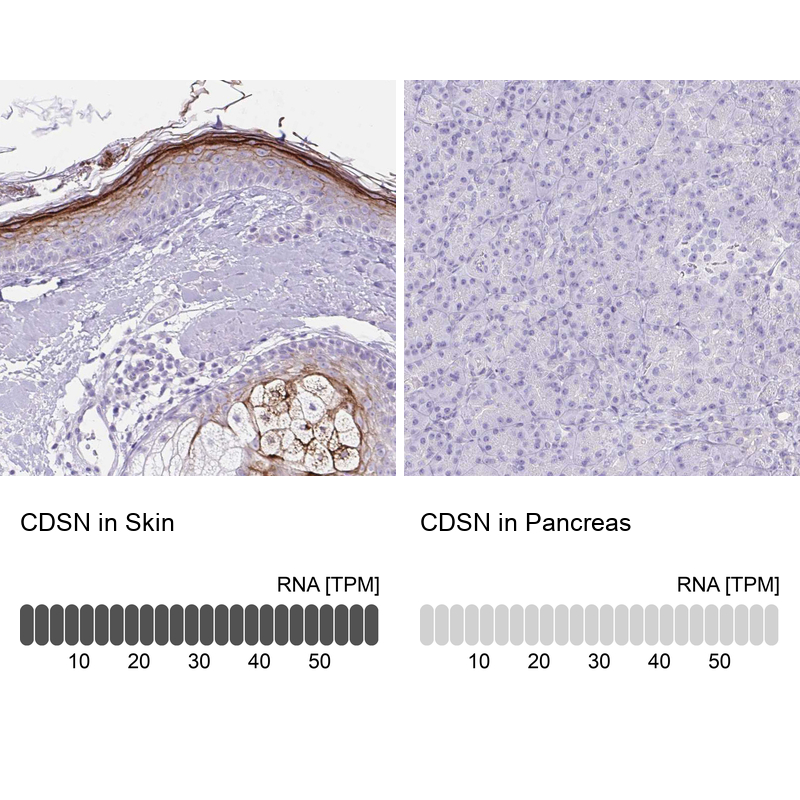 Anti-CDSN Antibody