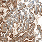 Immunohistochemical staining of human small intestine shows strong apical membranous positivity in glandular cells.
