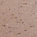 Immunohistochemical staining of human cerebral cortex shows moderate cytoplasmic positivity in neurons.