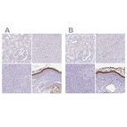 Immunohistochemical staining of human kidney, liver, pancreas and skin using Anti-CDSN antibody HPA054184 (A) shows similar protein distribution across tissues to independent antibody HPA044730 (B).