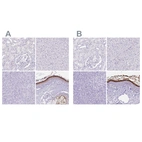 Immunohistochemical staining of human kidney, liver, pancreas and skin using Anti-CDSN antibody HPA054184 (A) shows similar protein distribution across tissues to independent antibody HPA044730 (B).
