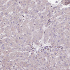 Immunohistochemical staining of human liver shows very weak cytoplasmic positivity in hepatocytes.