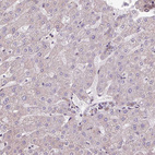 Anti-CCDC93 Antibody