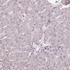 Immunohistochemical staining of human liver shows very weak cytoplasmic positivity in hepatocytes.