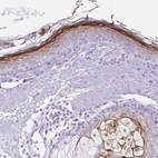 Immunohistochemical staining of human skin shows membranous positivity in epidermal cells.
