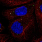 Immunofluorescent staining of human cell line A-431 shows localization to vesicles.