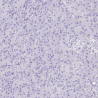 Immunohistochemical staining of human pancreas shows no positivity as expected.