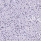 Immunohistochemical staining of human pancreas shows no positivity as expected.