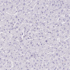 Immunohistochemical staining of human liver shows no positivity in hepatocytes as expected.