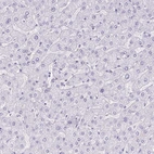 Immunohistochemical staining of human liver shows no positivity in hepatocytes as expected.