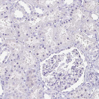 Immunohistochemical staining of human kidney shows no positivity in cells in tubules as expected.