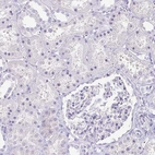 Immunohistochemical staining of human kidney shows no positivity in cells in tubules as expected.