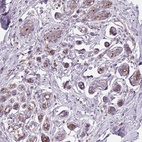 Anti-VTCN1 Antibody