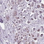 Anti-VTCN1 Antibody