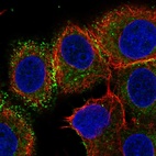 Anti-VTCN1 Antibody