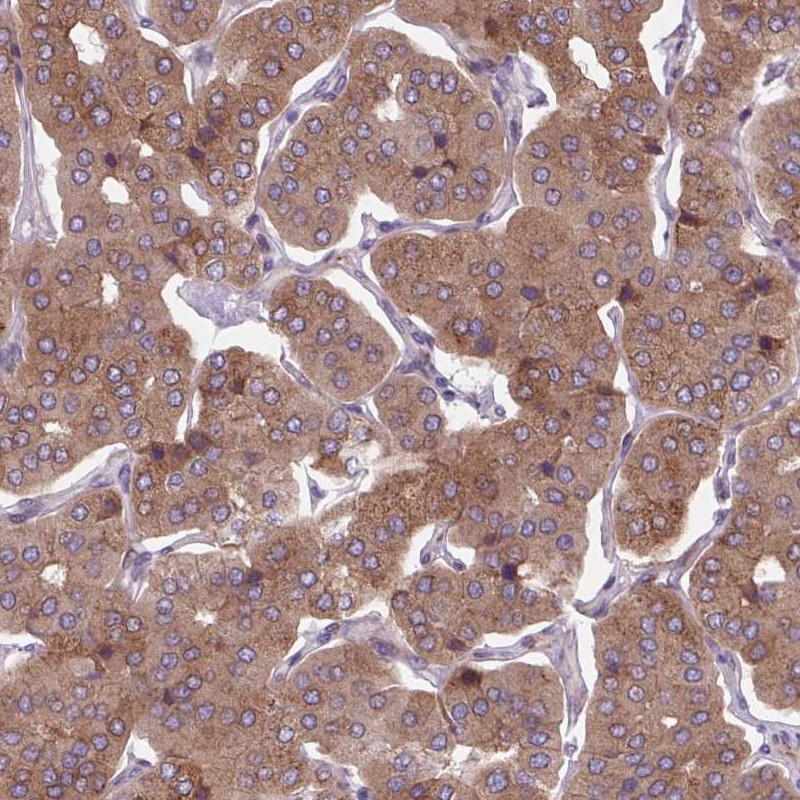 Anti-PLA2G4A Antibody