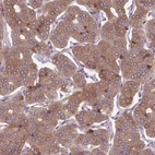Anti-PLA2G4A Antibody