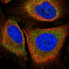 Immunofluorescent staining of human cell line HeLa shows localization to cytosol.