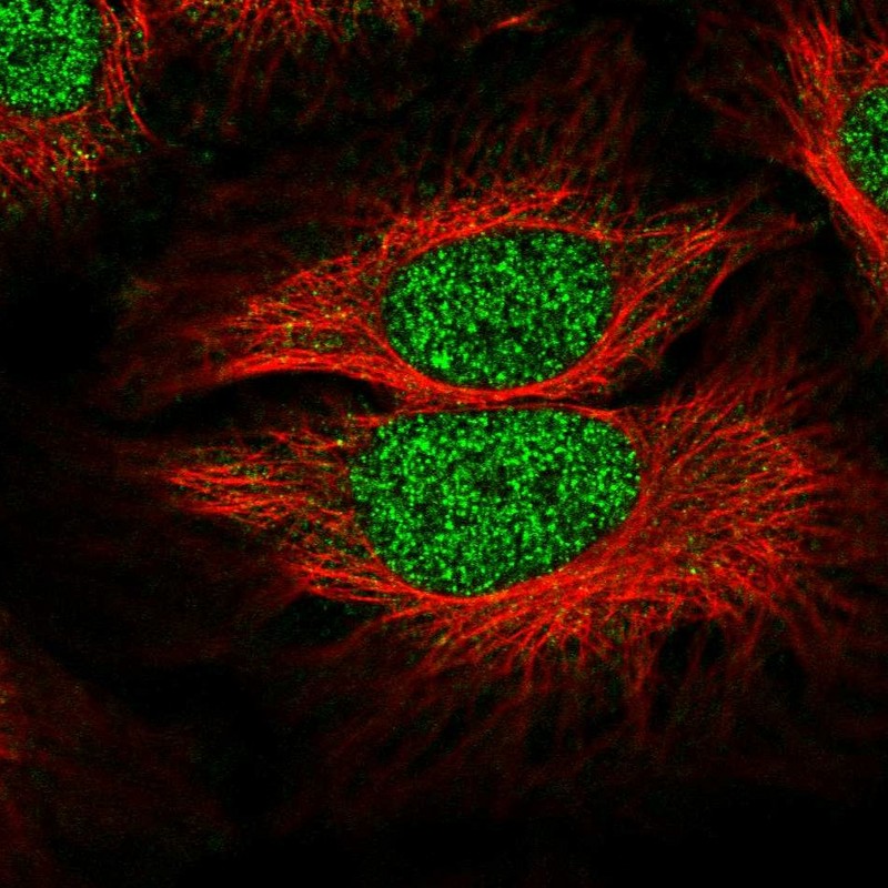 Anti-SLF1 Antibody