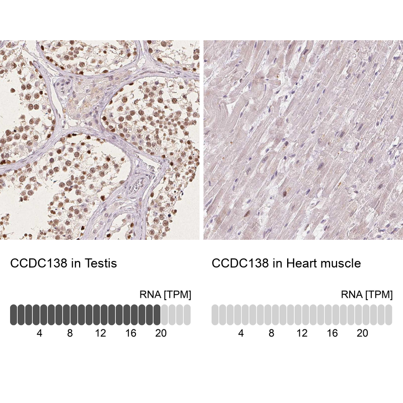 Anti-CCDC138 Antibody