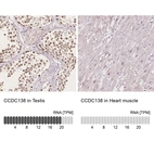 Anti-CCDC138 Antibody