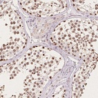 Anti-CCDC138 Antibody