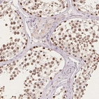 Immunohistochemical staining of human testis shows high expression.