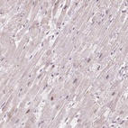 Immunohistochemical staining of human heart muscle shows low expression as expected.