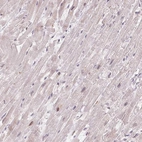 Immunohistochemical staining of human heart muscle shows low expression as expected.
