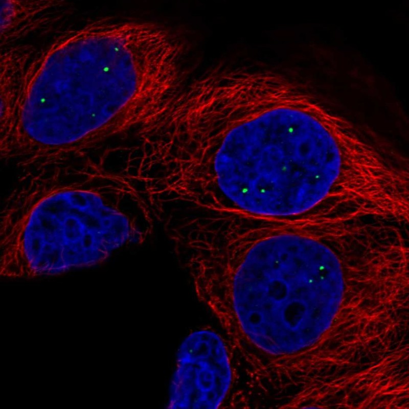 Anti-AMER3 Antibody