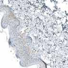 Immunohistochemical staining of human skin shows very weak positivity in squamous epithelial cells.