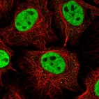 Immunofluorescent staining of human cell line HeLa shows localization to nucleoplasm.