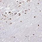 Anti-RCOR1 Antibody