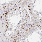 Immunohistochemical staining of human testis shows moderate nuclear positivity in cells in seminiferous ducts.