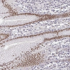 Immunohistochemical staining of human stomach shows moderate nuclear positivity in glandular cells.